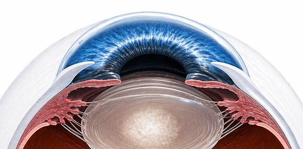 cataract eye image